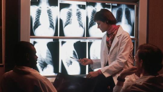 Qué son las densidades radiológicas | Blog iFP